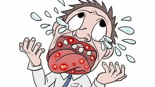 口腔溃疡的形成,为什么是白色的,看完你就懂了  口腔溃疡的形成,为什么是白色的,看完你就懂了