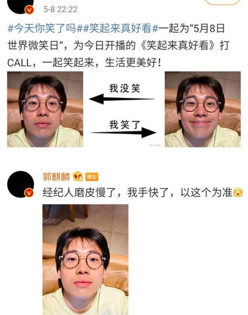  郭麒麟手快发自拍没磨皮,经纪人慌了,曾直怼电子刊手撕侵权