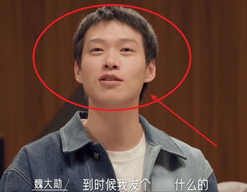  大勋摘头套太秃然,要不还是焊上吧,自暴自弃拍大片反被惊艳