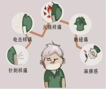  揭秘三叉神经痛不是牙痛,却比牙痛更甚