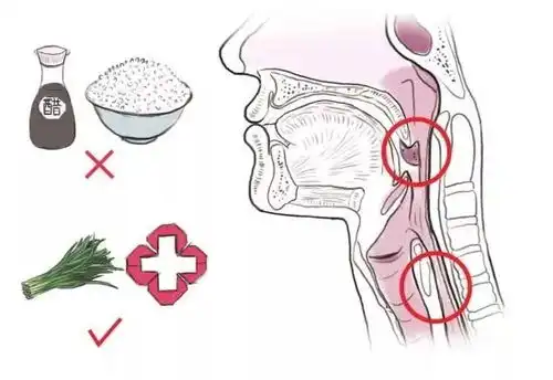  福州女子吃鱼误吞鱼刺穿肠,动手术取出3.6厘米长刺