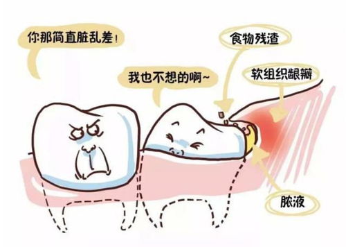  你还在说牙疼不是病当心要了你的命