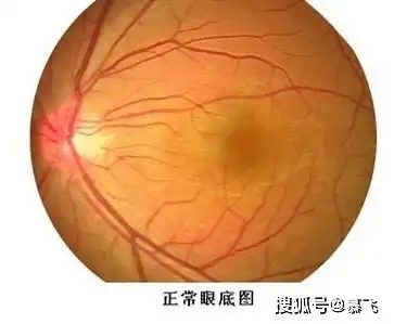  怎样的眼底检查,才能帮我们规避风险
