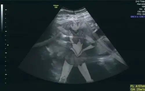  女朋友和我说她怀孕了情侣聊天记录流出太劲爆哈哈哈