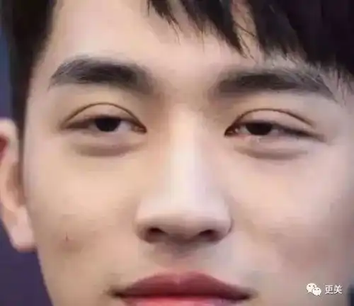  承认割双眼皮的戚薇又去整了34岁的她已经笑不动了