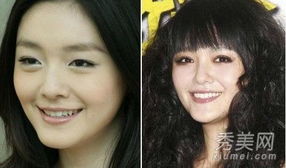  辣妈大s杨幂黄奕因整容失败变成鬼脸的女星