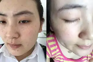  黄褐斑雀斑老年斑都怕地里的它,80岁老农试了一夜,斑点全都没了