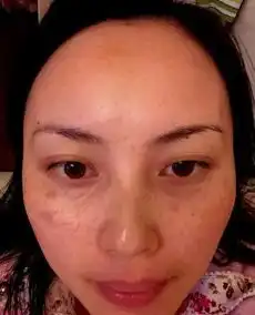  你可知女人下面有多脏,女人们别再无知了