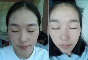  美太樱子祛斑效果怎么样
