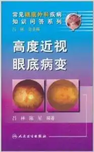  高度近视眼底病变