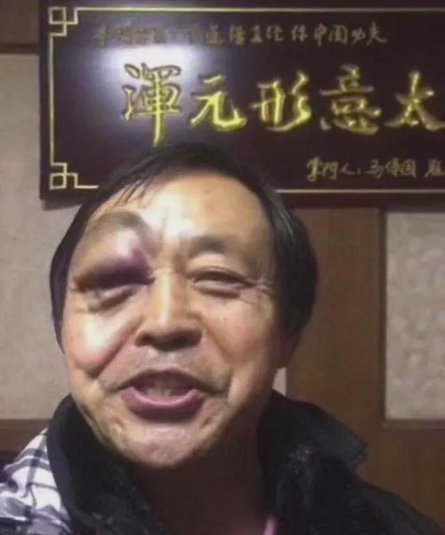  乌俄最新,德国再援爱国者,波斯的闪电五连鞭