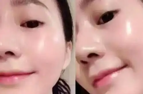  女人不想老太快,25岁后常吃这5种食物,补充胶原蛋白显年轻