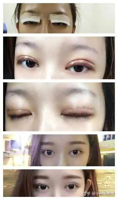 舔爷表情包割双眼皮