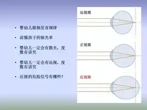  近视远视散光弱视配镜原则