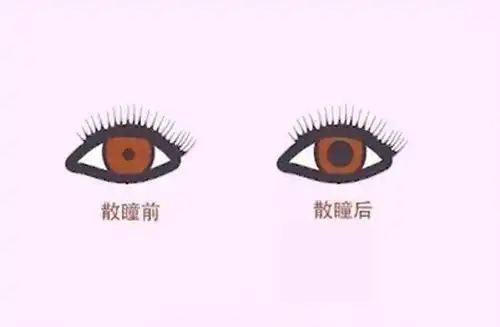  当心近视眼处理不当会引发视网膜脱落眼底出血黄斑病变