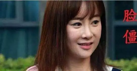  张檬整容失败,取出假体后首次现身,网友原装,美的令人嫉妒