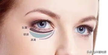  人们对眼袋还存有不少误区