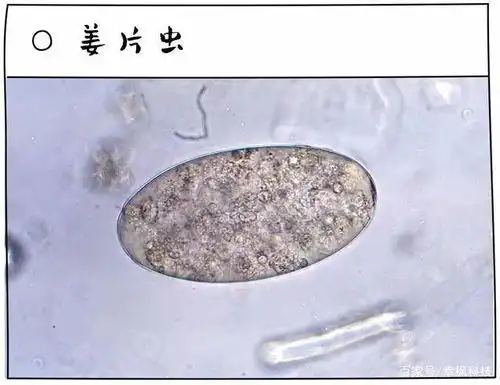  生吃荸荠会中毒营养师这些果蔬同样不宜生吃