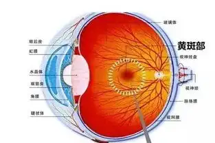  为什么说近视600度是一个很大的分水岭