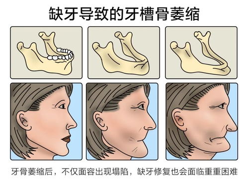  龙年福利名额发放,不限户籍,市民朋友皆可领取