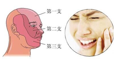 牙疼表情包三叉神经痛