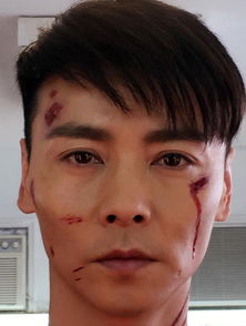  张晋晒带伤妆容照炫夫狂魔蔡少芬依旧说帅