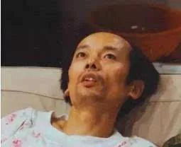  游泳磨腋下不是病,磨起来还真要命