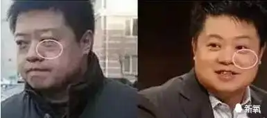 李沁最近怎么老了10岁90后小花几乎都遭遇了这个部位衰老 李沁最近怎么老了10岁90后小花几乎都遭遇了这个部位衰老